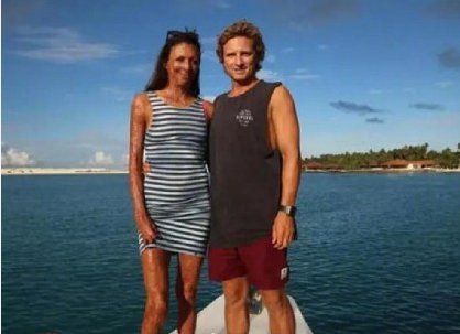 澳洲模特被大火毁容其男友不离不弃是真的吗？