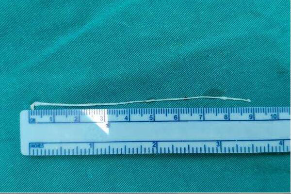 3MM等于多少厘来自米
