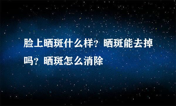 脸上晒斑什么样？晒斑能去掉吗？晒斑怎么消除