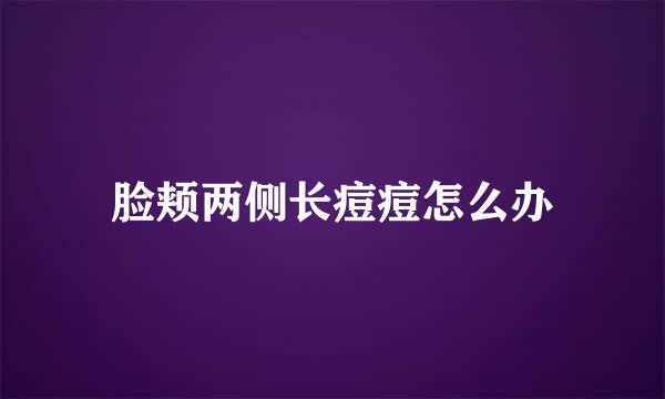 脸颊两侧长痘痘怎么办