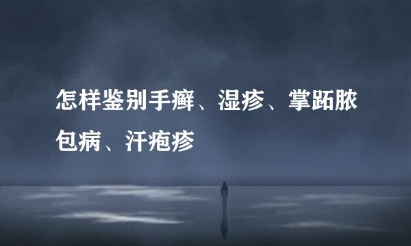怎样鉴别手癣、湿疹、掌跖脓包病、汗疱疹