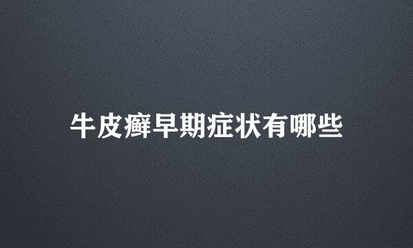 牛皮癣早期症状有哪些
