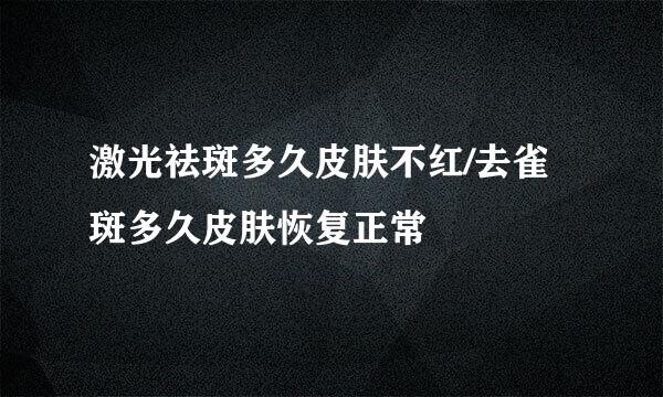 激光祛斑多久皮肤不红/去雀斑多久皮肤恢复正常
