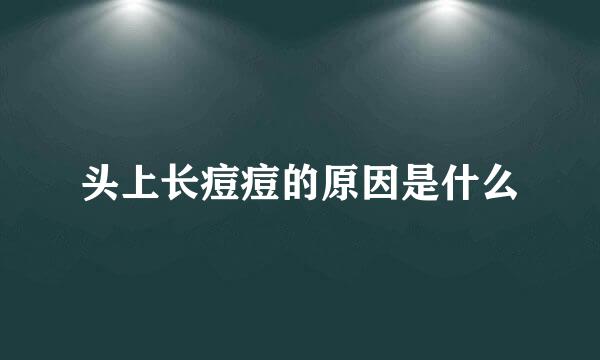 头上长痘痘的原因是什么