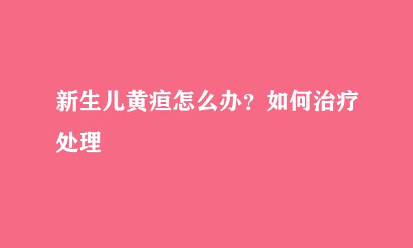 新生儿黄疸怎么办？如何治疗处理