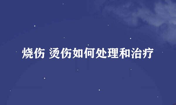 烧伤 烫伤如何处理和治疗