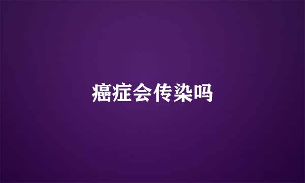 癌症会传染吗
