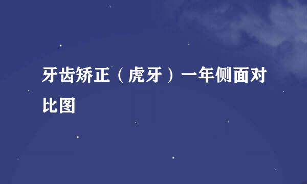 牙齿矫正（虎牙）一年侧面对比图