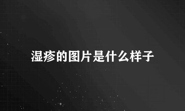 湿疹的图片是什么样子
